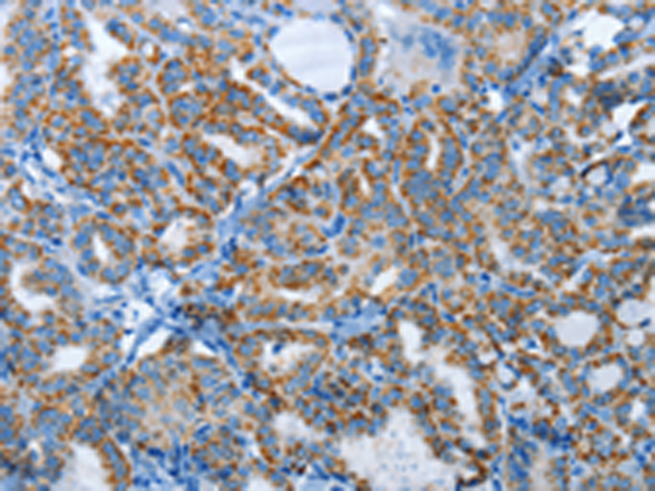 Anti-AGL Rabbit Polyclonal Antibody