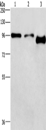 Anti-PIP5K1C Rabbit Polyclonal Antibody