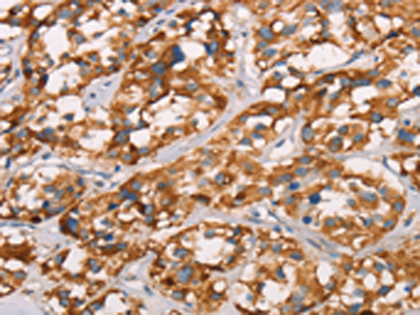 Anti-SPR Rabbit Polyclonal Antibody