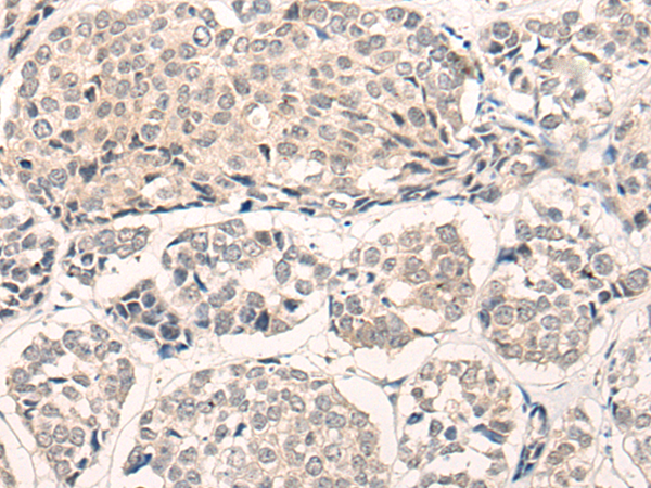 Anti-ENT1 Rabbit Polyclonal Antibody