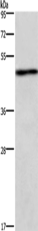 Anti-UHMK1 Rabbit Polyclonal Antibody