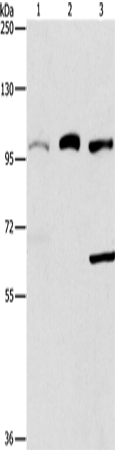 Anti-ASCC2 Rabbit Polyclonal Antibody