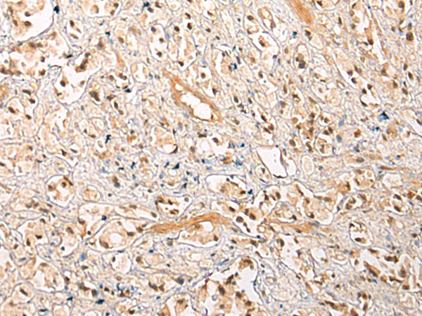 Anti-ASPP1 Rabbit Polyclonal Antibody