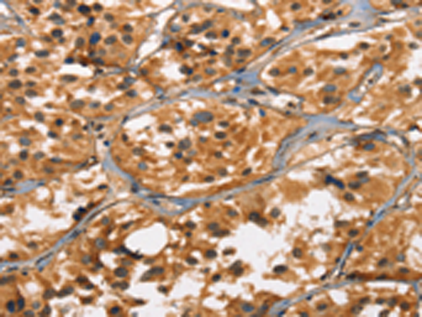 Anti-DEFA5 Rabbit Polyclonal Antibody