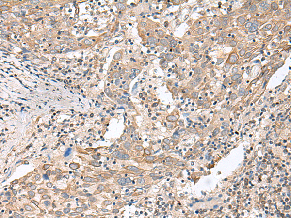 Anti-MMP2 Rabbit Polyclonal Antibody