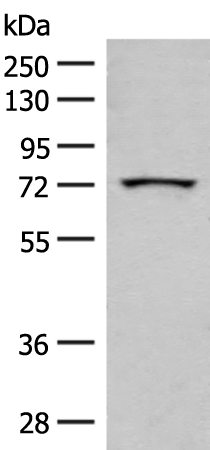 Anti-MMP2 Rabbit Polyclonal Antibody
