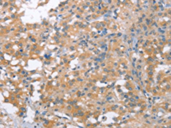 Anti-NLRP7 Rabbit Polyclonal Antibody