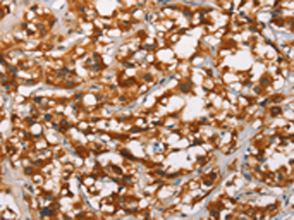 Anti-ADNP Rabbit Polyclonal Antibody