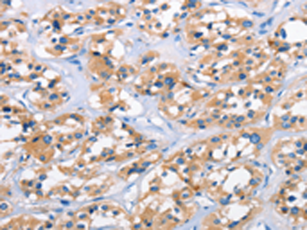 Anti-ApoL6 Rabbit Polyclonal Antibody