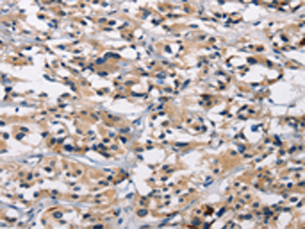 Anti-ARSB Rabbit Polyclonal Antibody