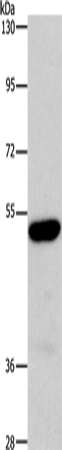 Anti-ARSB Rabbit Polyclonal Antibody