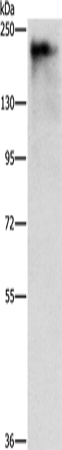 Anti-ATAD5 Rabbit Polyclonal Antibody