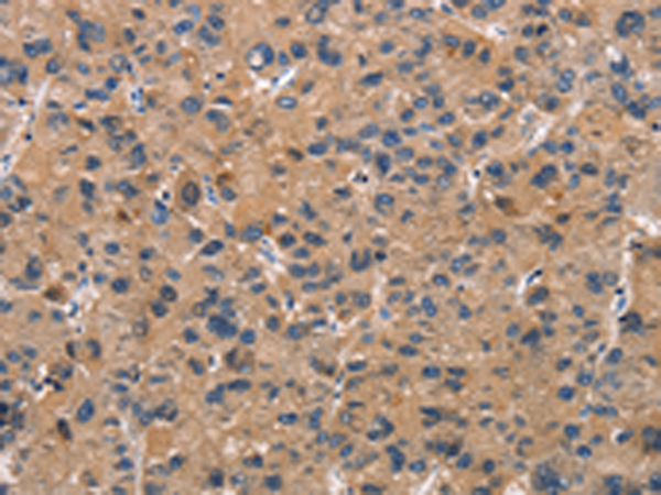 Anti-ATP7A Rabbit Polyclonal Antibody