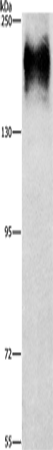 Anti-ATP7A Rabbit Polyclonal Antibody