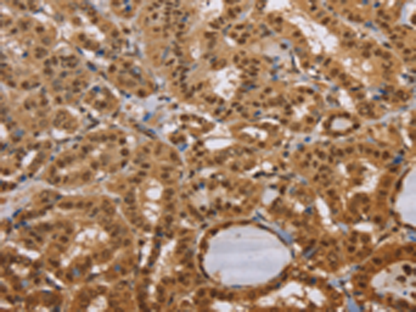 Anti-CEL Rabbit Polyclonal Antibody