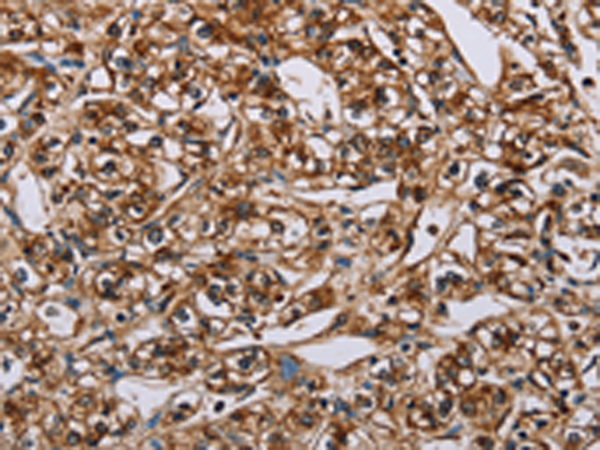 Anti-BMP6 Rabbit Polyclonal Antibody