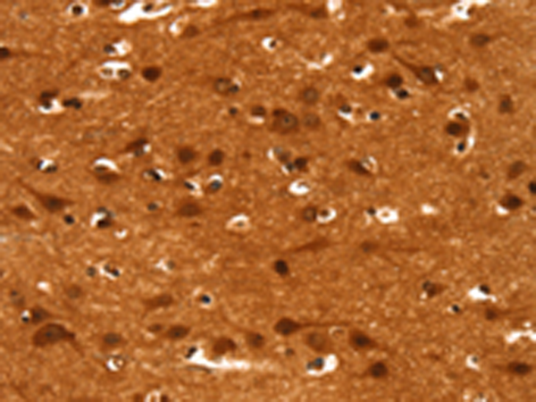 Anti-CACNA1E Rabbit Polyclonal Antibody