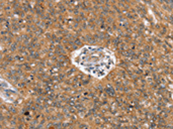 Anti-Cell Adhesion Molecule 4 Rabbit Polyclonal Antibody