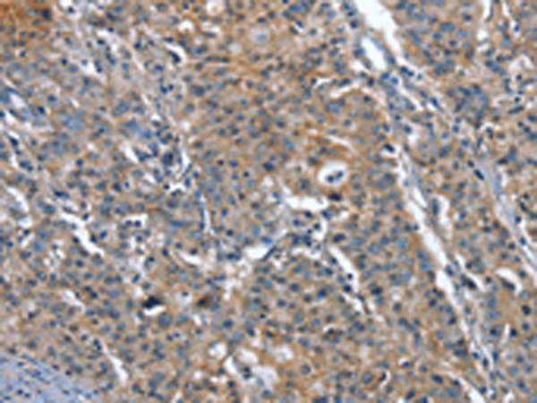 Anti-PLA2G6 Rabbit Polyclonal Antibody