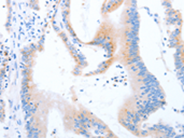 Anti-MSP Rabbit Polyclonal Antibody