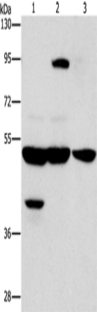 Anti-MSP Rabbit Polyclonal Antibody