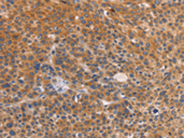 Anti-Cathepsin C Rabbit Polyclonal Antibody