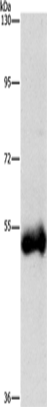 Anti-Cathepsin C Rabbit Polyclonal Antibody