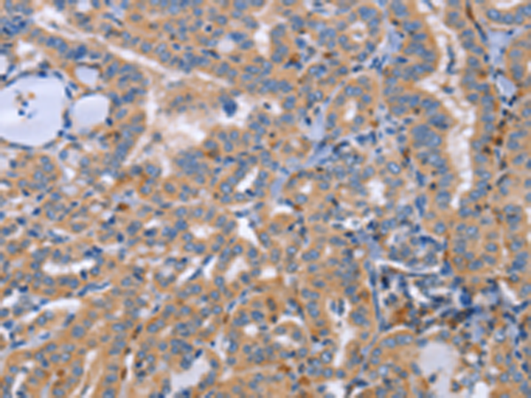 Anti-SIGLEC7 Rabbit Polyclonal Antibody