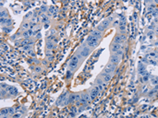 Anti-ICAM1 Rabbit Polyclonal Antibody