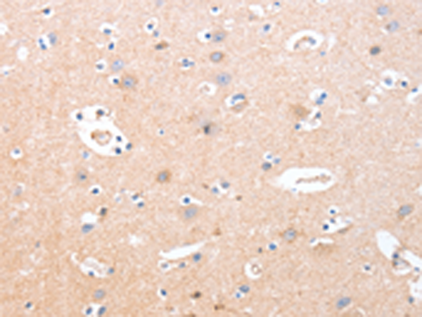 Anti-B3GAT1 Rabbit Polyclonal Antibody