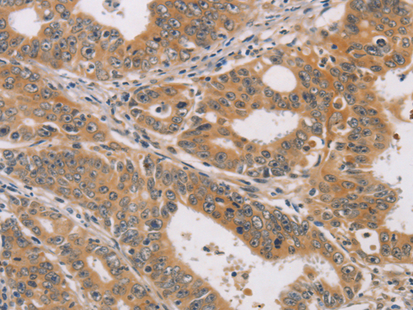 Anti-CDK11A/CDK11B Rabbit Polyclonal Antibody