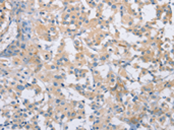 Anti-CDCP1 Rabbit Polyclonal Antibody