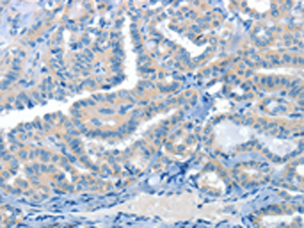 Anti-CRLF2 Rabbit Polyclonal Antibody