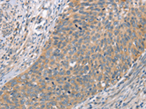 Anti-CRHR2 Rabbit Polyclonal Antibody
