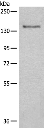 Anti-CTR9 Rabbit Polyclonal Antibody