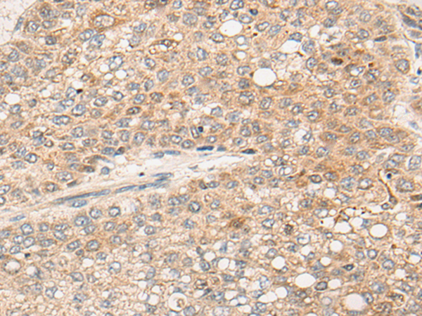 Anti-CXorf36 Rabbit Polyclonal Antibody
