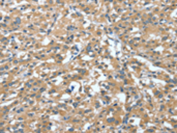 Anti-DTX1 Rabbit Polyclonal Antibody