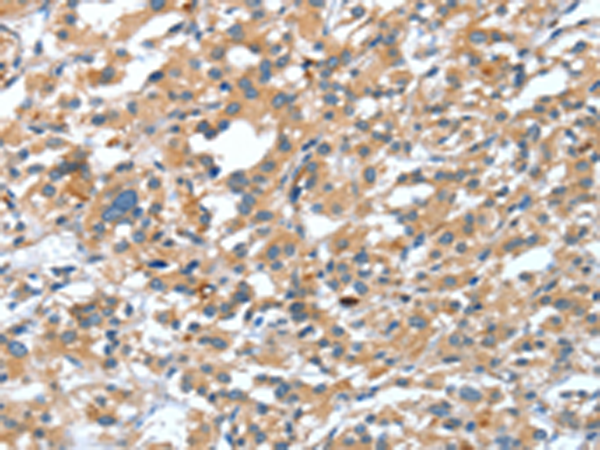 Anti-DSC1 Rabbit Polyclonal Antibody