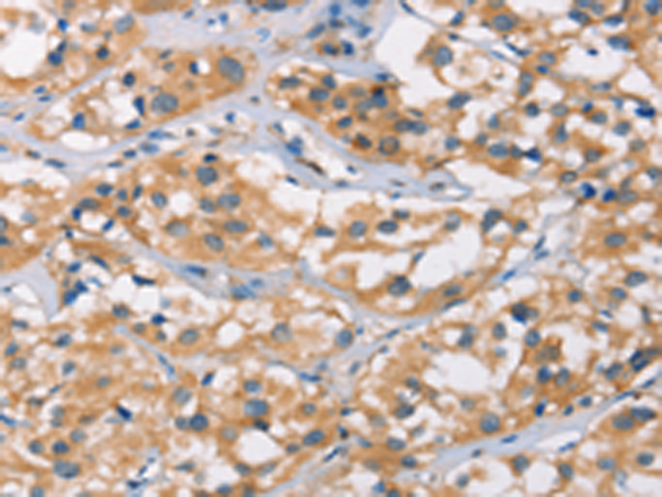Anti-DSC2 Rabbit Polyclonal Antibody