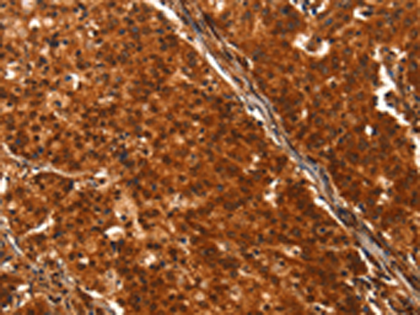 Anti-DHH Rabbit Polyclonal Antibody