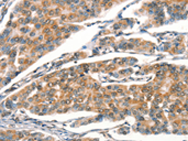 Anti-STK17A Rabbit Polyclonal Antibody