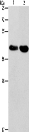 Anti-STK17A Rabbit Polyclonal Antibody