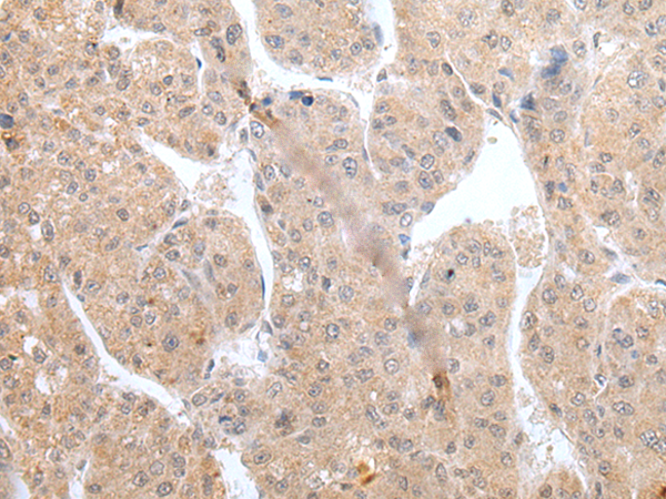 Anti-Kv2.1 Rabbit Polyclonal Antibody