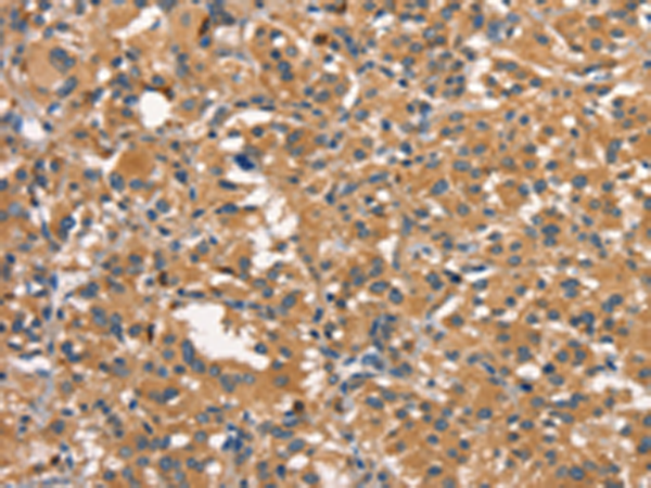 Anti-Dynamin 2 Rabbit Polyclonal Antibody