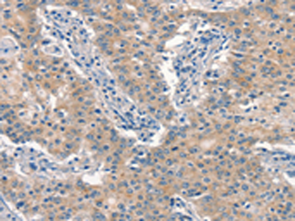 Anti-EID3 Rabbit Polyclonal Antibody