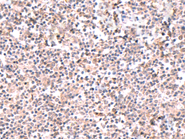 Anti-ELOVL6 Rabbit Polyclonal Antibody