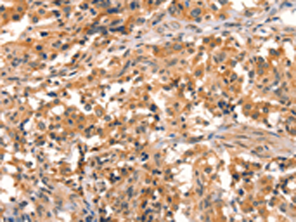 Anti-Eppin Rabbit Polyclonal Antibody