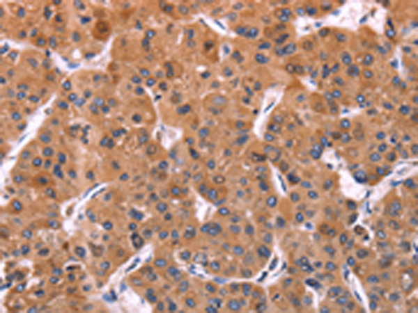 Anti-ERp29 Rabbit Polyclonal Antibody