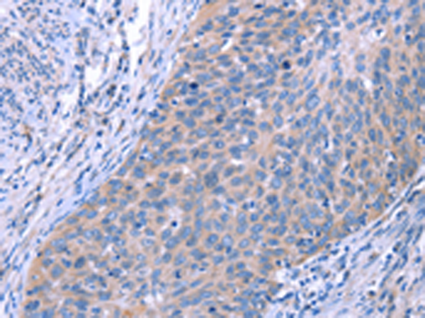 Anti-ESPL1 Rabbit Polyclonal Antibody