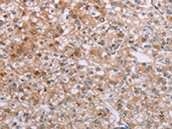 Anti-ETFB Rabbit Polyclonal Antibody